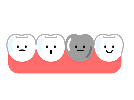 金歯と銀歯の違い