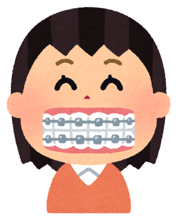 歯科矯正のメリット