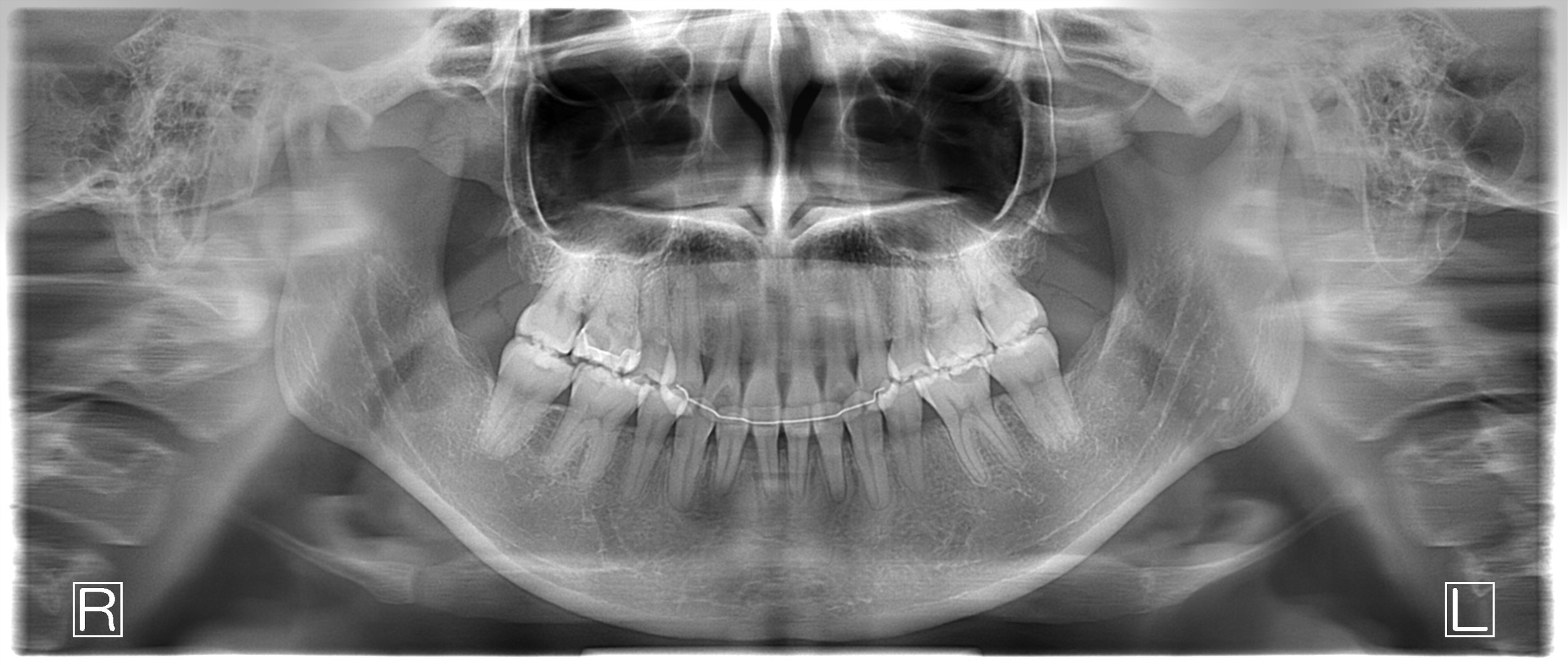 歯医者でレントゲンを撮るのはなぜ？💭