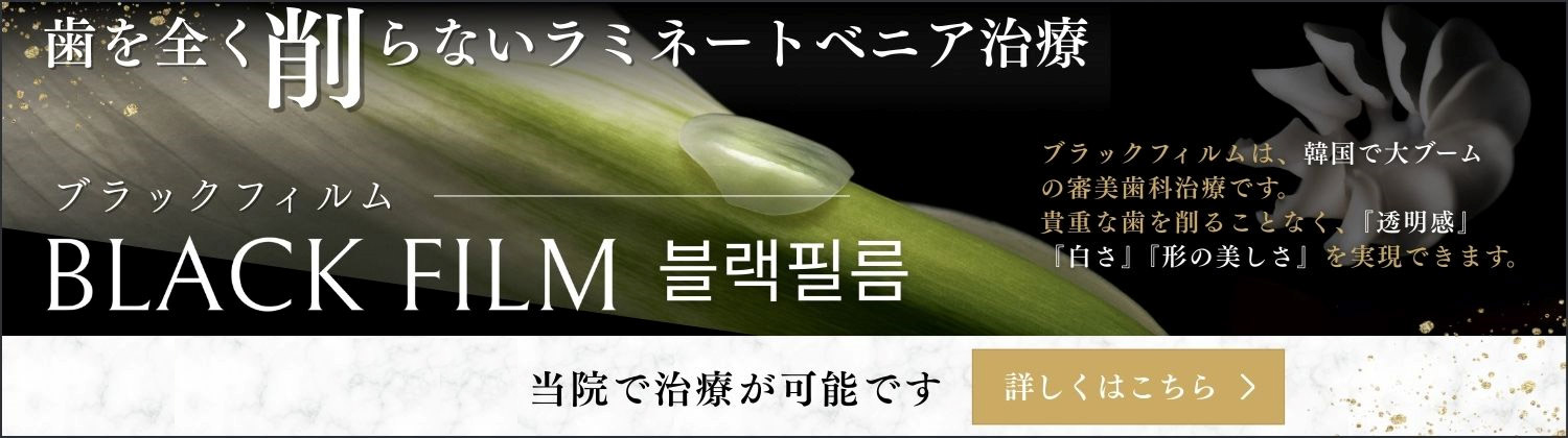 歯を全く削らないラミネートベニア治療