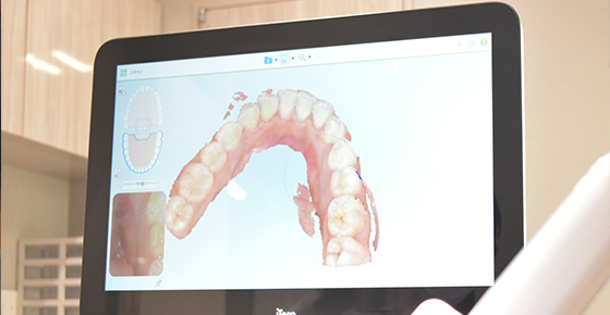 アニメーションを使用して、分かりやすくご説明