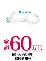 インビザラインFULL