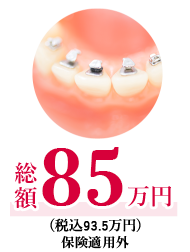 ハーフリンガル