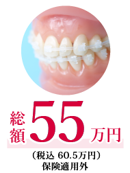 クリアブラケット＋ホワイトワイヤー