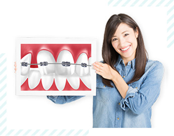 部分的な矯正治療で歯並びを整えられるかもしれません