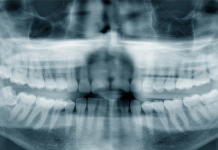 歯並びや顎の骨などの状態をチェックする精密検査……30,000円（税抜）