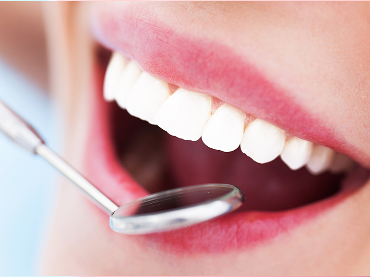 当院ではTION（ティオン）の薬剤を使用しています